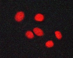 Invitrogen Phospho-VDR (Ser208) Polyclonal Antibody 100 &mu;L; Unconjugated:Antibodies,