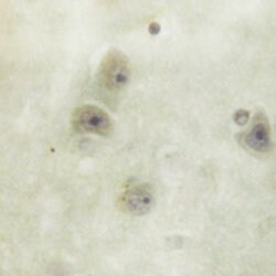 Invitrogen Phospho-SRC (Ser75) Polyclonal Antibody 100 &mu;L | Buy Online | Invitrogen&trade; | Fisher Scientific