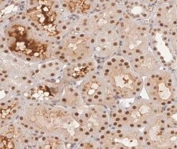 Invitrogen Phospho-GYS1 (Ser645) Polyclonal Antibody 100 &mu;L | Buy Online | Invitrogen&trade; | Fisher Scientific