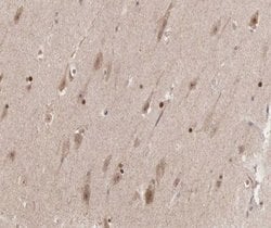 Invitrogen Phospho-Cyclin B1 (Ser126) Polyclonal Antibody 100 &mu;L; Unconjugated:Antibodies,
