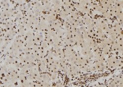 Invitrogen Phospho-B-RAF (Ser446) Polyclonal Antibody 100 μL; Unconjugated:Antibodies,