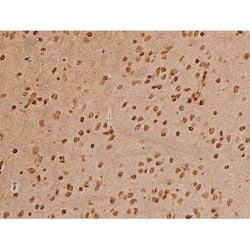 Invitrogen Phospho-Ezrin (Tyr354) Polyclonal Antibody 100 &mu;L; Unconjugated:Antibodies,