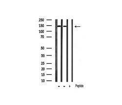 Invitrogen Phospho-Ezrin (Tyr354) Polyclonal Antibody 100 &mu;L; Unconjugated:Antibodies,