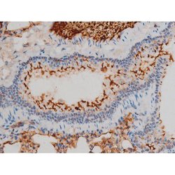 Invitrogen Phospho-Ezrin (Tyr478) Polyclonal Antibody 100 &mu;L; Unconjugated:Antibodies,