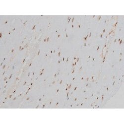Invitrogen Phospho-Ezrin (Tyr478) Polyclonal Antibody 100 &mu;L; Unconjugated:Antibodies,