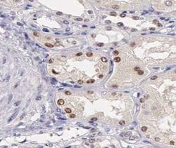 Phospho-ATF2 (Ser62, Ser44) Polyclonal Antibody, Invitrogen 100 &mu;L;