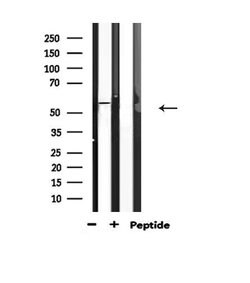 Phospho-ATF2 (Ser62, Ser44) Polyclonal Antibody, Invitrogen 100 &mu;L;
