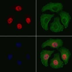 Invitrogen Phospho-ATF2 (Thr69, Thr51) Polyclonal Antibody 100 &mu;L; Unconjugated:Antibodies,