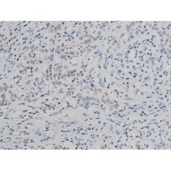 Invitrogen Phospho-ATF2 (Thr69, Thr51) Polyclonal Antibody 100 &mu;L; Unconjugated:Antibodies,