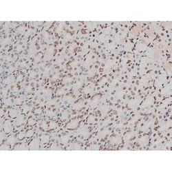 Invitrogen Phospho-ATF2 (Thr69, Thr51) Polyclonal Antibody 100 &mu;L; Unconjugated:Antibodies,