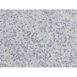 Invitrogen Phospho-ATF2 (Thr69, Thr51) Polyclonal Antibody 100 &mu;L; Unconjugated:Antibodies,