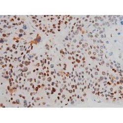 Invitrogen Phospho-ATF2 (Thr69, Thr51) Polyclonal Antibody 100 &mu;L; Unconjugated:Antibodies,