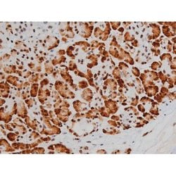 Invitrogen Phospho-ATF2 (Thr69, Thr51) Polyclonal Antibody 100 &mu;L; Unconjugated:Antibodies,