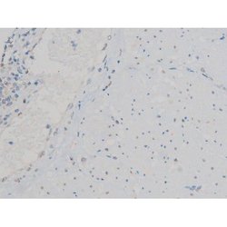 Invitrogen Phospho-ATF2 (Thr71, Thr53) Polyclonal Antibody 100 &mu;L; Unconjugated:Antibodies,