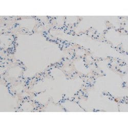 Invitrogen Phospho-ATF2 (Thr71, Thr53) Polyclonal Antibody 100 &mu;L; Unconjugated:Antibodies,