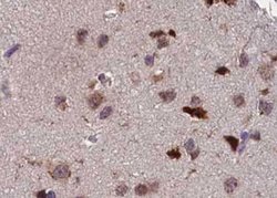 Invitrogen Phospho-ATF2 (Thr73, Thr55) Polyclonal Antibody 100 &mu;L; Unconjugated:Antibodies,