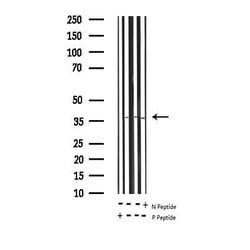 Invitrogen Phospho-RPA32 (Thr21) Polyclonal Antibody 100 &mu;L | Buy Online | Invitrogen&trade; | Fisher Scientific