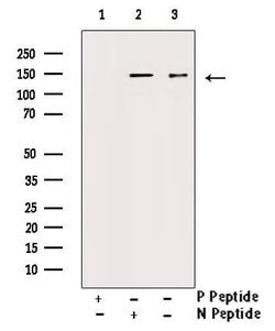 Invitrogen Phospho-PDGFRa (Tyr849) Polyclonal Antibody 100 &mu;L | Buy Online | Invitrogen&trade; | Fisher Scientific
