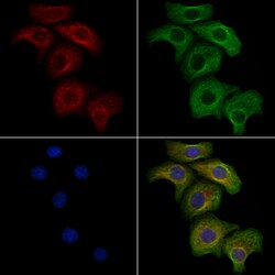 Invitrogen Phospho-CD31 (Tyr713) Polyclonal Antibody 100 μL; Unconjugated:Antibodies,