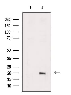 Invitrogen Phospho-Stathmin 1 (Ser25) Polyclonal Antibody 100 &mu;L; Unconjugated:Antibodies,