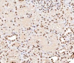 Invitrogen Phospho-Stathmin 1 (Ser38) Polyclonal Antibody 100 &mu;L | Buy Online | Invitrogen&trade; | Fisher Scientific