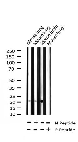 Invitrogen Phospho-Stathmin 1 (Ser38) Polyclonal Antibody 100 &mu;L | Buy Online | Invitrogen&trade; | Fisher Scientific