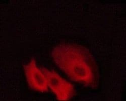 Invitrogen Phospho-PKC Pan (Thr497) Polyclonal Antibody 100 &mu;L; Unconjugated:Antibodies,