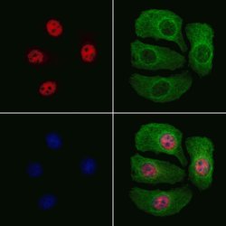 Invitrogen Phospho-JunB (Ser259) Polyclonal Antibody 100 &mu;L | Buy Online | Invitrogen&trade; | Fisher Scientific