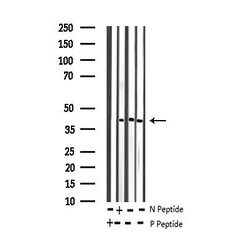 Invitrogen Phospho-JunB (Ser259) Polyclonal Antibody 100 &mu;L | Buy Online | Invitrogen&trade; | Fisher Scientific