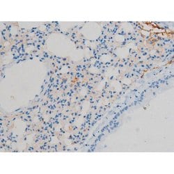 Invitrogen Phospho-Connexin 43 (Ser368) Polyclonal Antibody 100 &mu;L;