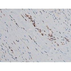 Invitrogen Phospho-JunD (Ser255) Polyclonal Antibody 100 &mu;L; Unconjugated:Antibodies,