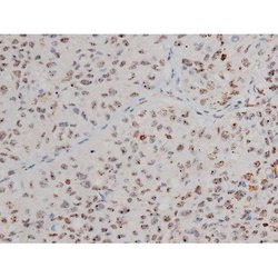 Invitrogen Phospho-JunD (Ser255) Polyclonal Antibody 100 &mu;L; Unconjugated:Antibodies,