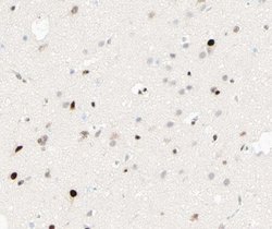 Invitrogen Phospho-C/EBP beta (Thr235, Thr188) Polyclonal Antibody 100