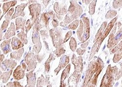 Invitrogen Phospho-Vinculin (Tyr822) Polyclonal Antibody 100 μL; Unconjugated:Antibodies,