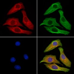 Invitrogen Phospho-Vinculin (Tyr822) Polyclonal Antibody 100 μL; Unconjugated:Antibodies,