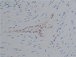 Invitrogen Phospho-PLCG1 (Tyr771) Polyclonal Antibody 100 &mu;L; Unconjugated:Antibodies,