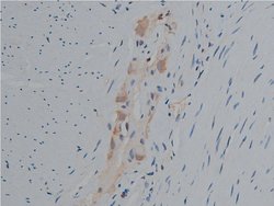 Invitrogen Phospho-PLCG1 (Tyr771) Polyclonal Antibody 100 &mu;L; Unconjugated:Antibodies,