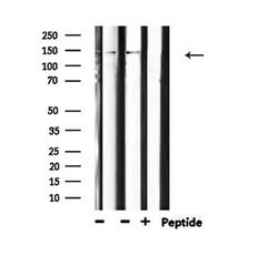 Invitrogen Phospho-PLCG1 (Tyr771) Polyclonal Antibody 100 &mu;L; Unconjugated:Antibodies,