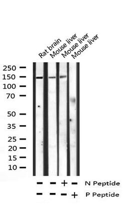Invitrogen Phospho-PLCG1 (Tyr783) Polyclonal Antibody 100 &mu;L; Unconjugated:Antibodies,