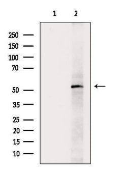 Invitrogen Phospho-EpoR (Tyr368) Polyclonal Antibody 100 &mu;L; Unconjugated:Antibodies,