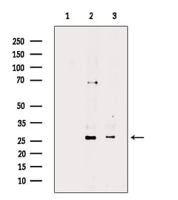 Invitrogen Phospho-Cardiac Troponin I (Ser44) Polyclonal Antibody 100 &mu;L;