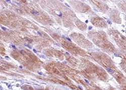 Invitrogen Phospho-Cardiac Troponin I (Ser44) Polyclonal Antibody 100 &mu;L;