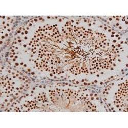 Invitrogen Phospho-Filamin A (Ser2152) Polyclonal Antibody 100 μL; Unconjugated:Antibodies,