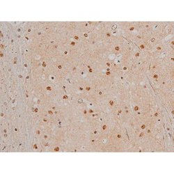 Invitrogen Phospho-Filamin A (Ser2152) Polyclonal Antibody 100 μL; Unconjugated:Antibodies,