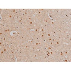 Invitrogen Phospho-Filamin A (Ser2152) Polyclonal Antibody 100 μL; Unconjugated:Antibodies,