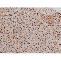 Invitrogen Phospho-Filamin A (Ser2152) Polyclonal Antibody 100 μL; Unconjugated:Antibodies,