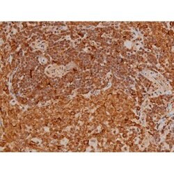 Invitrogen Phospho-Filamin A (Ser2152) Polyclonal Antibody 100 μL; Unconjugated:Antibodies,