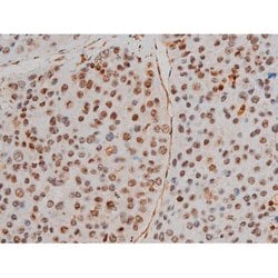 Invitrogen Phospho-Filamin A (Ser2152) Polyclonal Antibody 100 μL; Unconjugated:Antibodies,