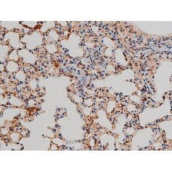 Invitrogen Phospho-Filamin A (Ser2152) Polyclonal Antibody 100 μL; Unconjugated:Antibodies,