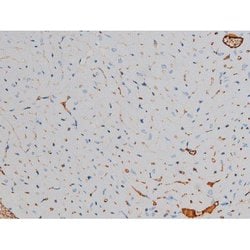 Invitrogen Phospho-p70 S6 Kinase (Ser371) Polyclonal Antibody 100 &mu;L;